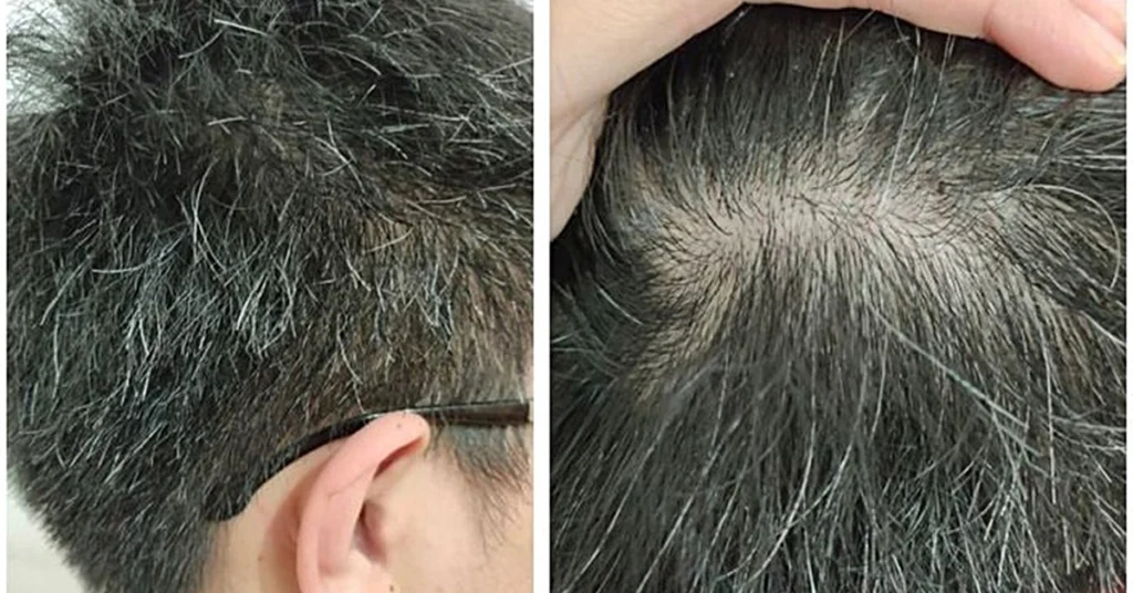 Giải pháp cải thiện tình trạng tóc bạc